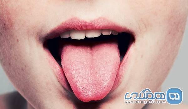 حس چشایی افراد چاق با حس چشایی افراد لاغر چه تفاوتی دارد؟ حس چشایی افراد چاق با حس چشایی افراد لاغر چه تفاوتی دارد؟